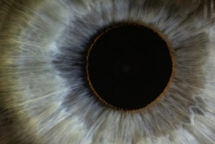 Auge